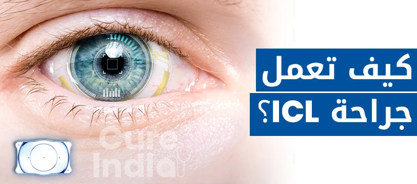 كيف تعمل جراحة ICL